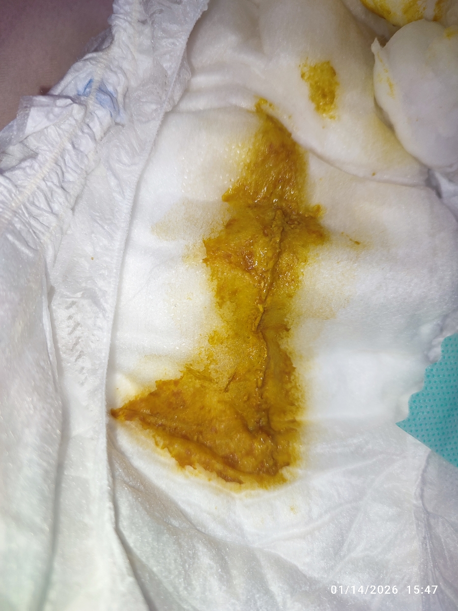 جواب آزمایش تیروئید نوزاد جواب آزمایش تیروئید نوزاد