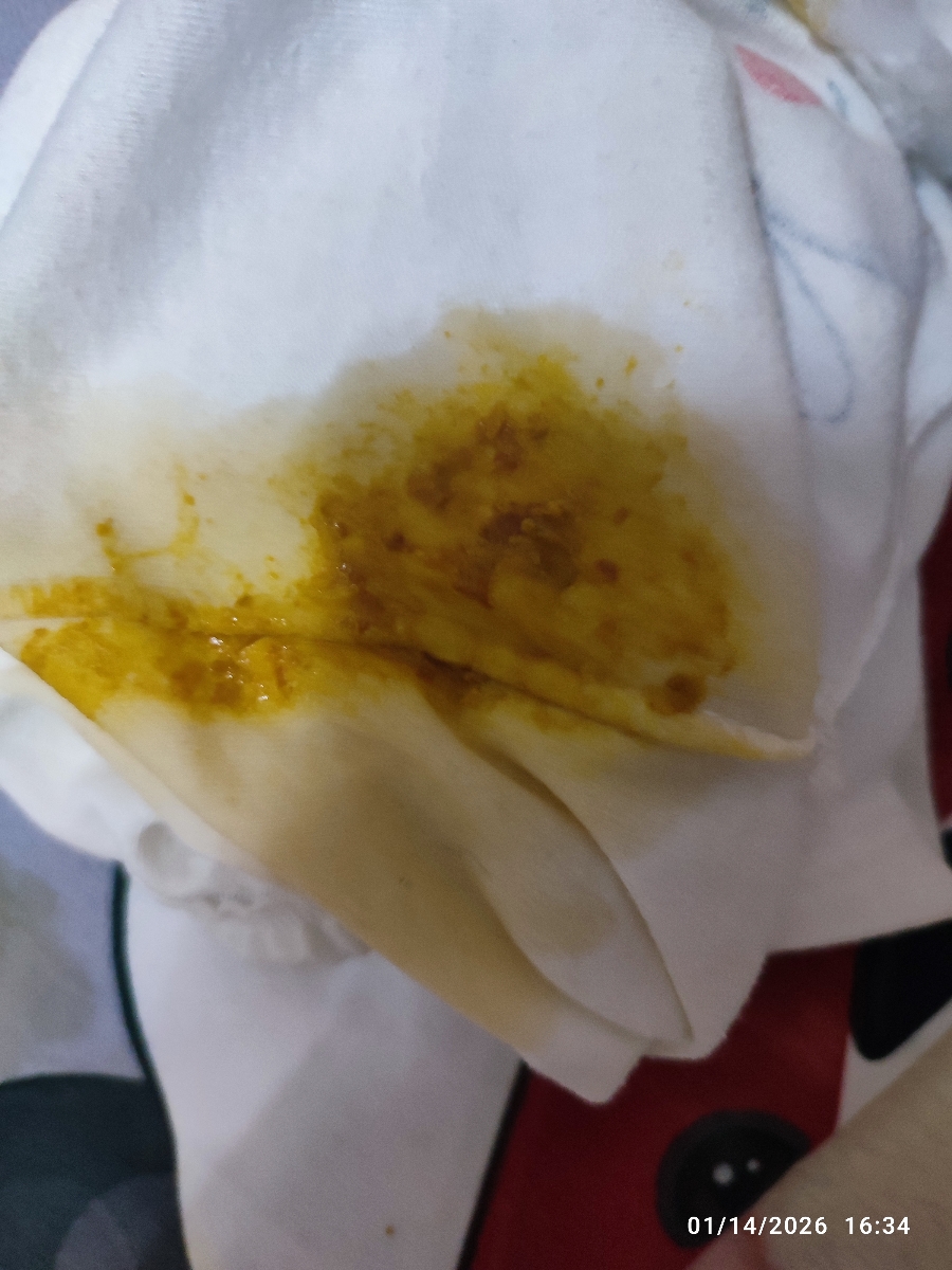 جواب آزمایش تیروئید نوزاد جواب آزمایش تیروئید نوزاد