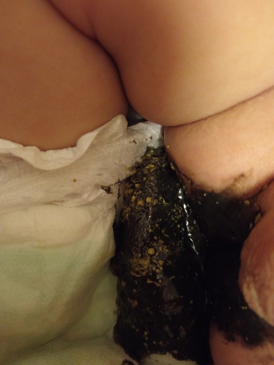 مدفوع پسرم (عکس) مدفوع پسرم (عکس)