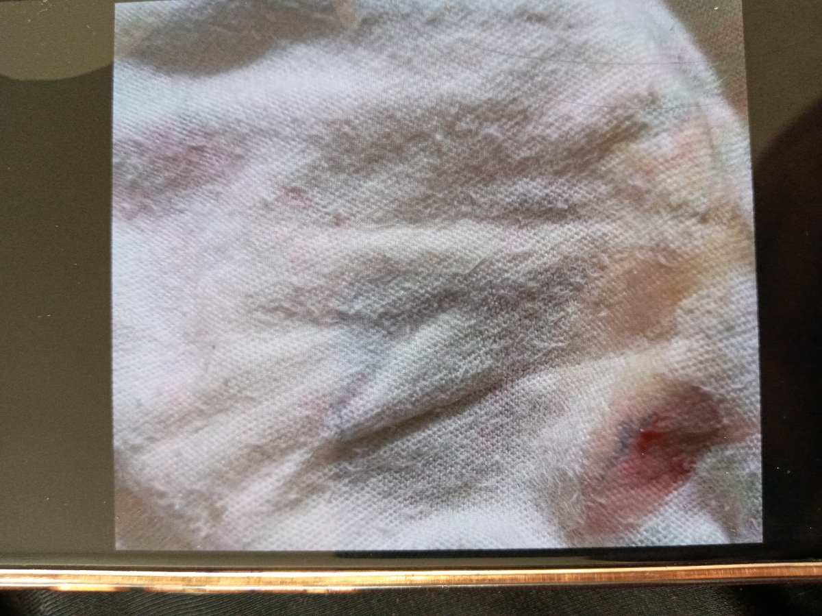 ترشح سبز رنگ در بارداری