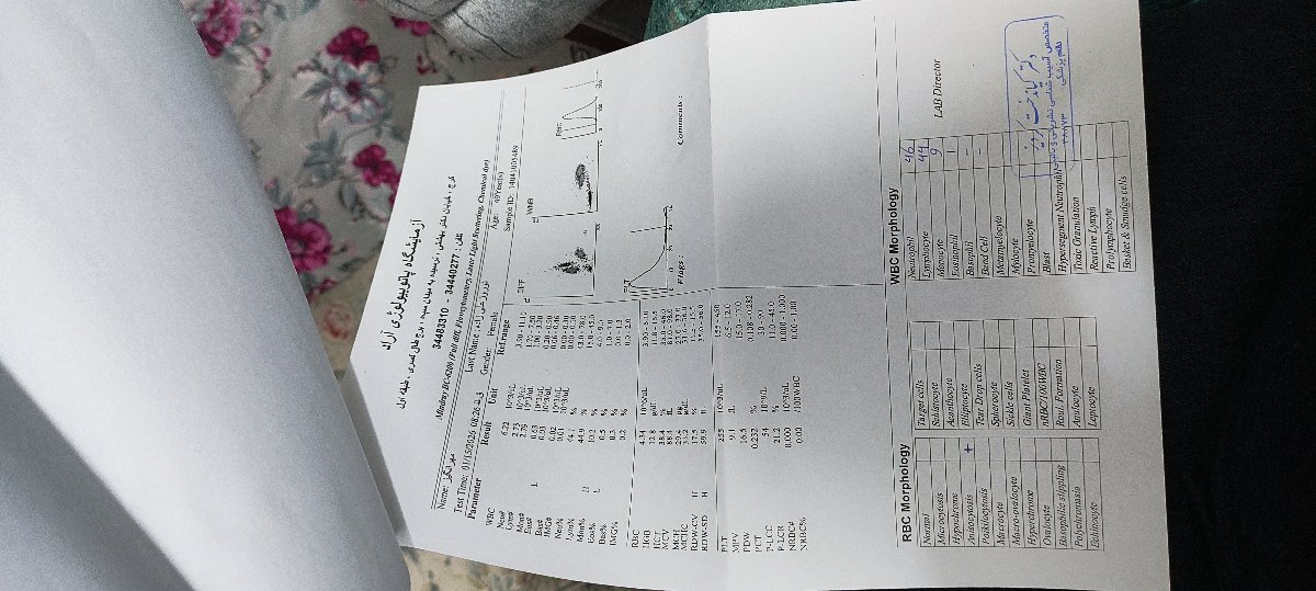 تفسیر آزمایش مهم شیمی درمانی