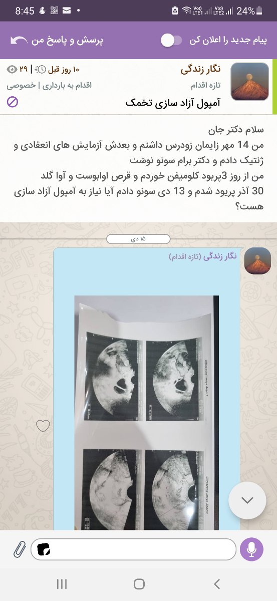 تفسیر آزمایش اقدام بارداری