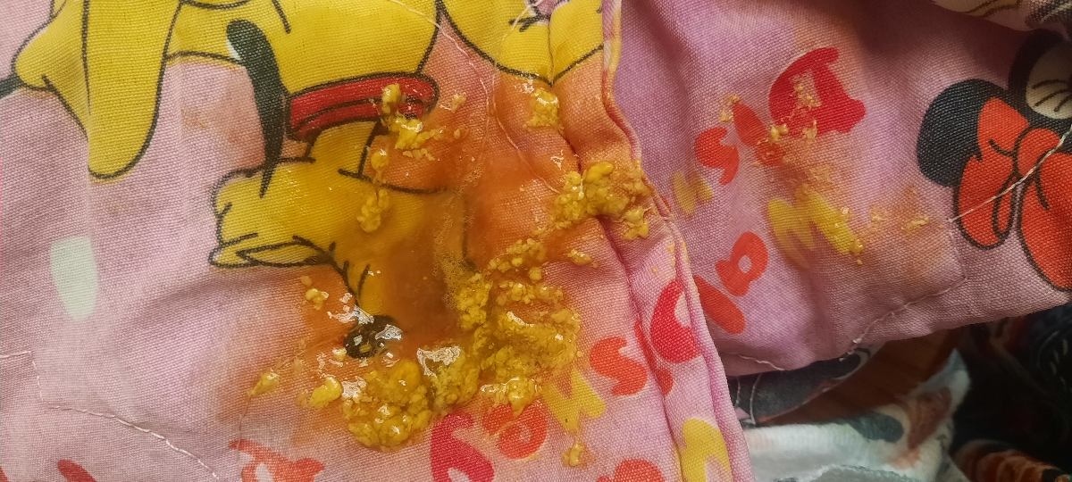 جواب ازمایش های پسرم جواب ازمایش های پسرم