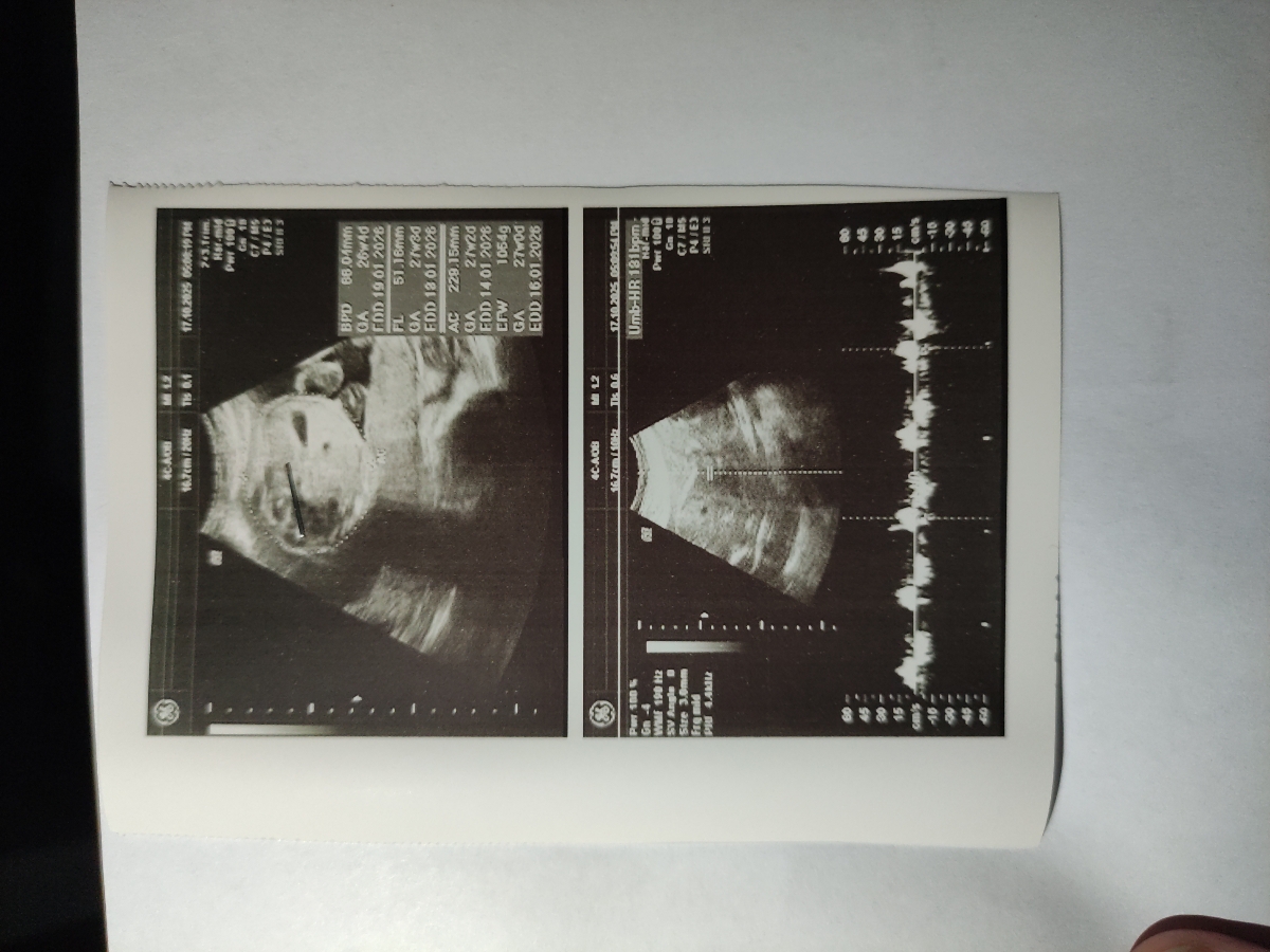 وزن نوزاد و مادر