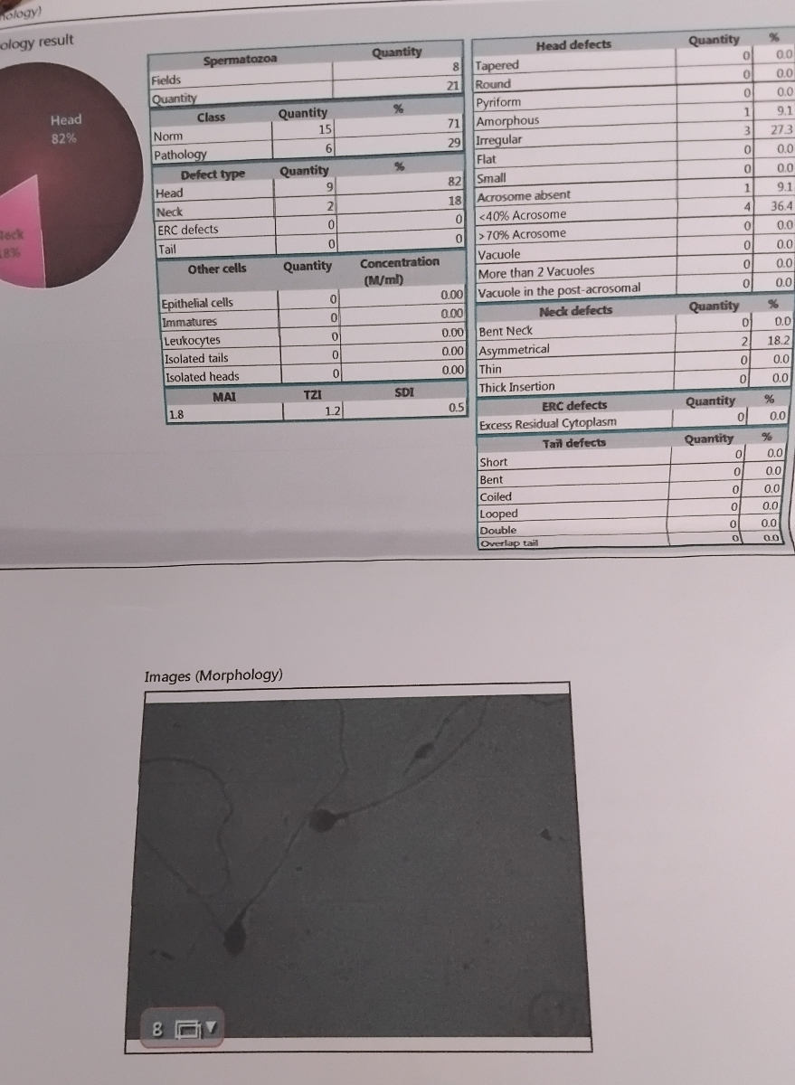 برای تقویت اسپرم چه راهکارهایی انجام بدیم