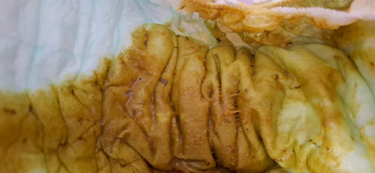 مدفوع نوزاد ۷ ماهه همراه عکس