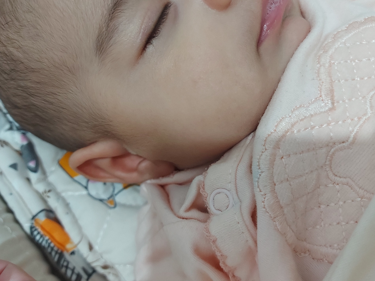 ازمایش مدفوع نوزاد 3ماهه