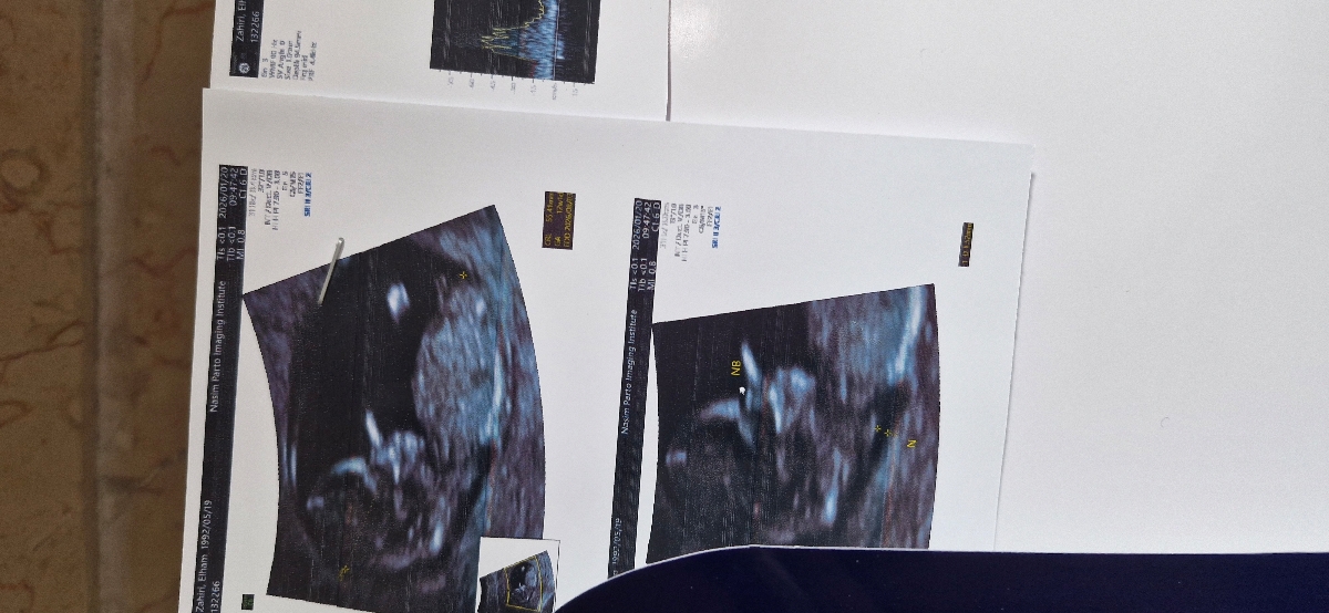 ممنون میشم سونو ان تی منو تفسیر کنید🙏