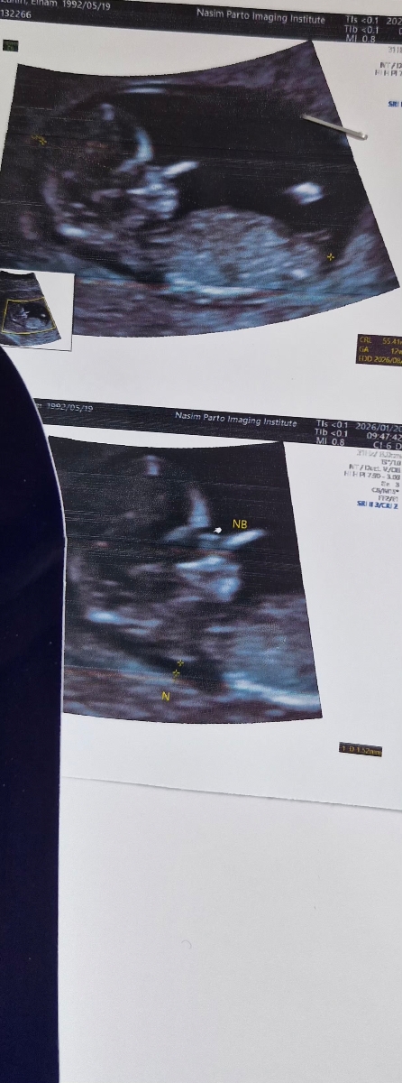 ممنون میشم سونو ان تی منو تفسیر کنید🙏