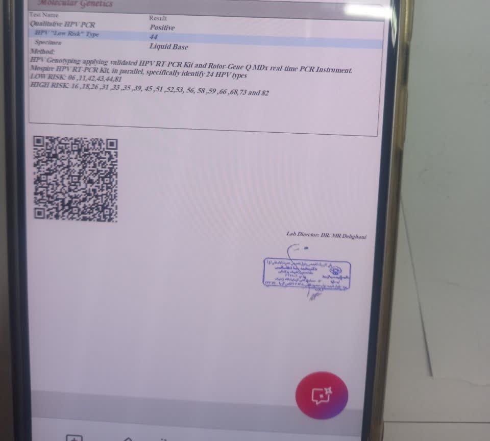 اچ پی وی مثبت دکتر جان بیا لطفاً