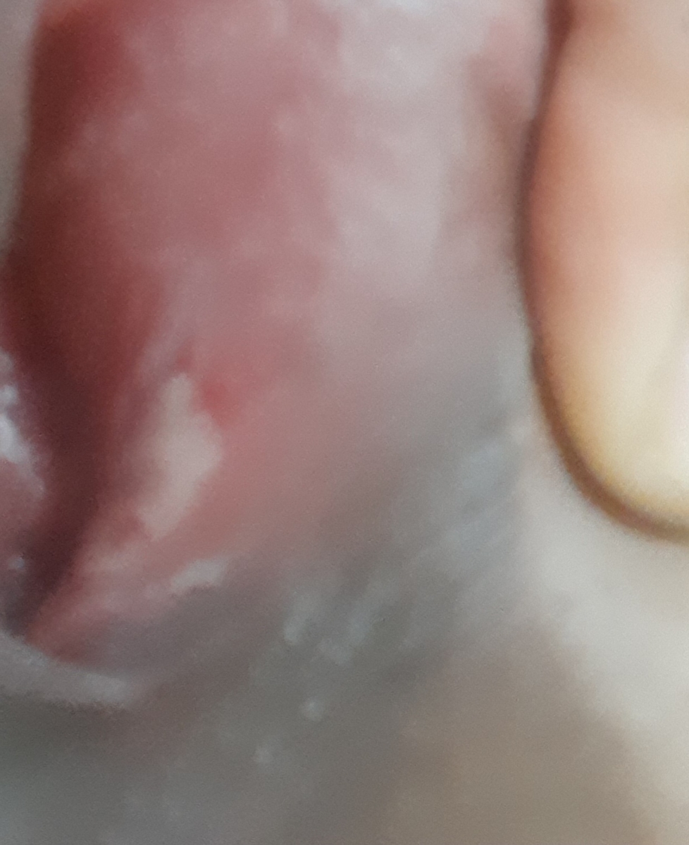 اینطوری شده سفیدشده انگار شبیه افت دهانیه اینطوری شده سفیدشده انگار شبیه افت دهانیه