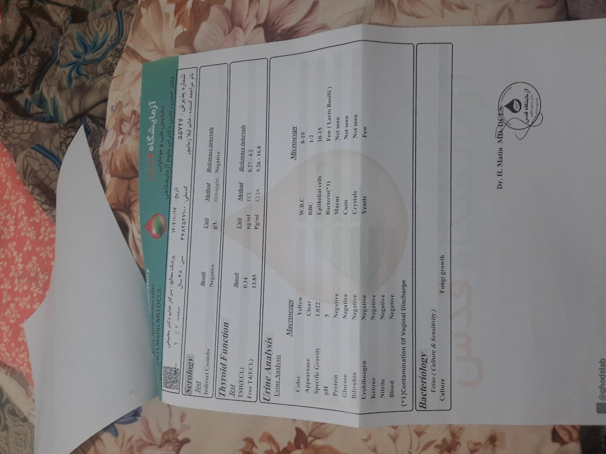 روماتیسم علت سقط ؟