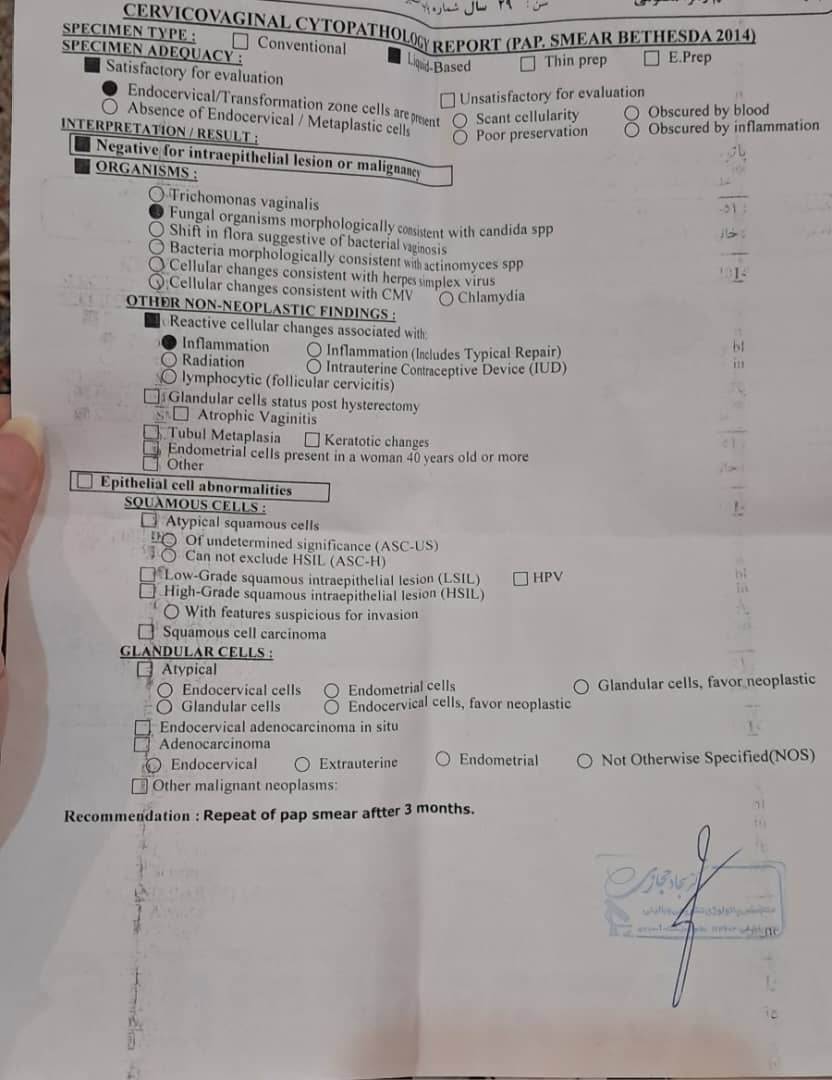 این هست پاپ اسمیرشون