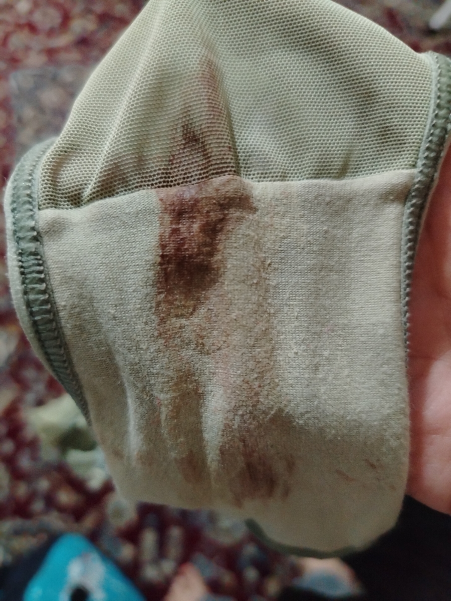 این عکس
اگه بدتون میاد نگاه نکنید💫💫