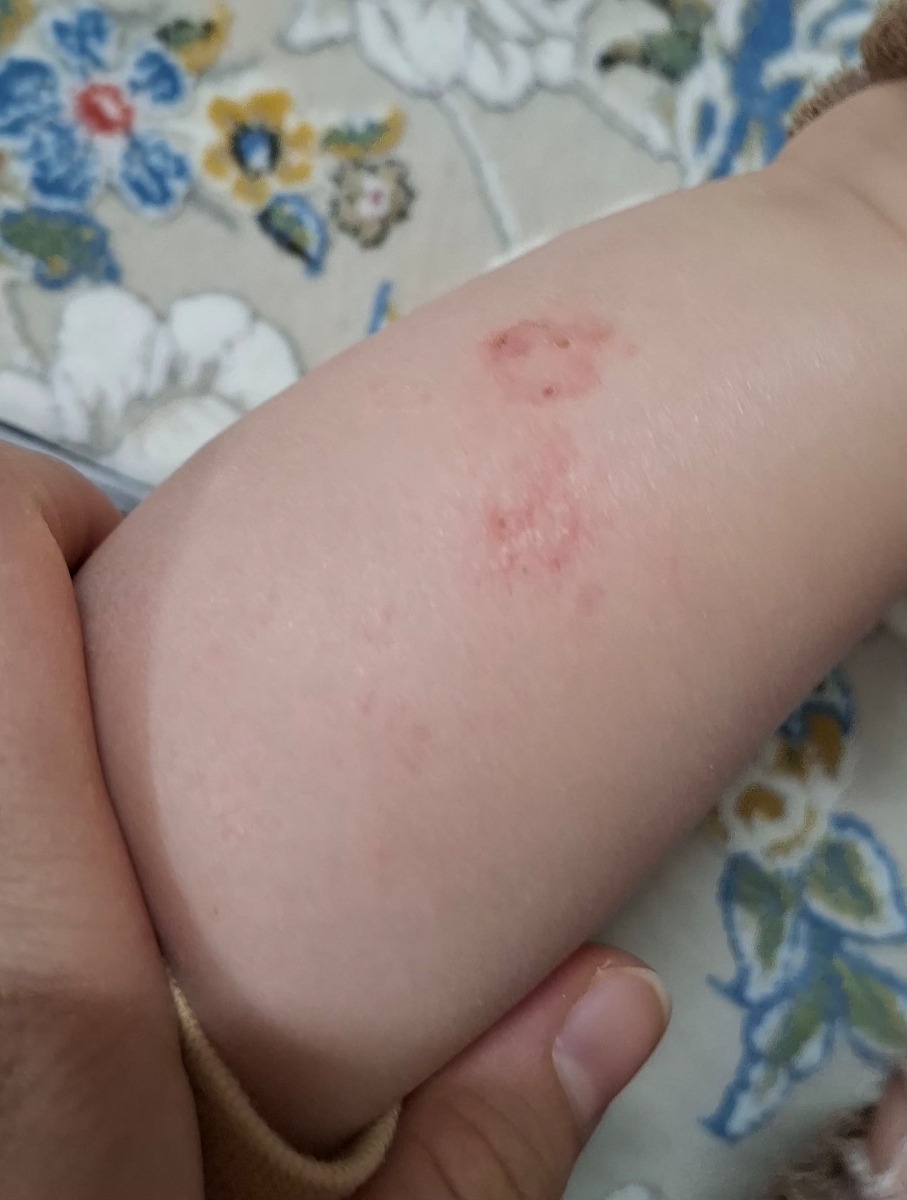 بعدش این همون پا هست