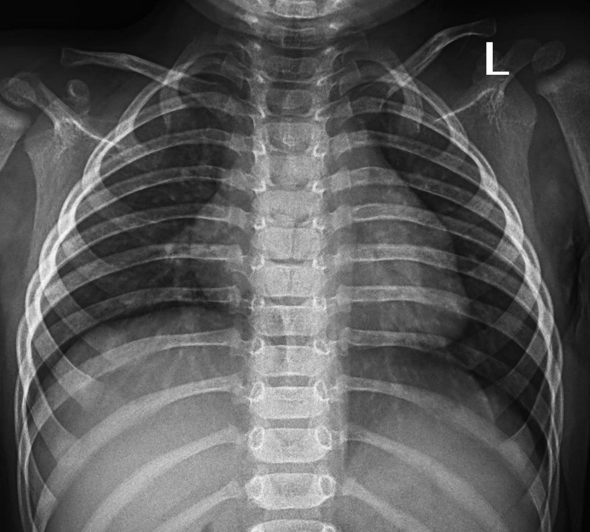 عسل برای سرفه و سرماخوردگی