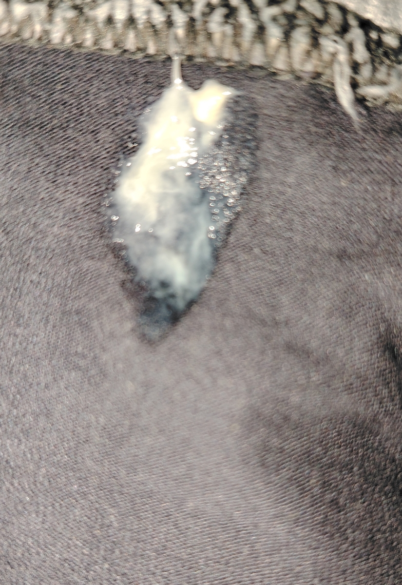 تفسیر آزمایش آنزیم های کبدی