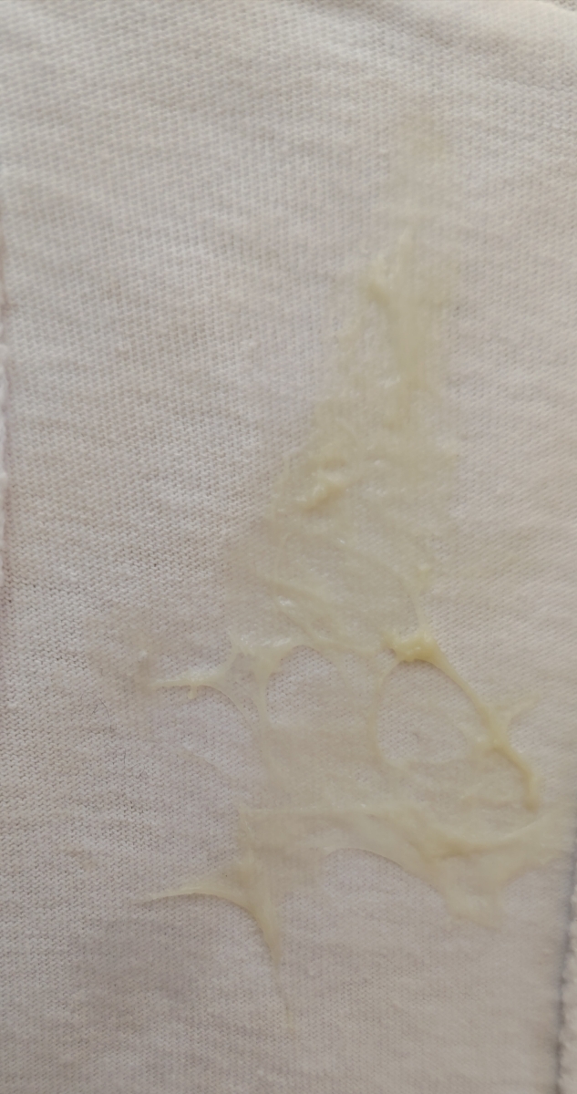 تفسیر آزمایش آنزیم های کبدی