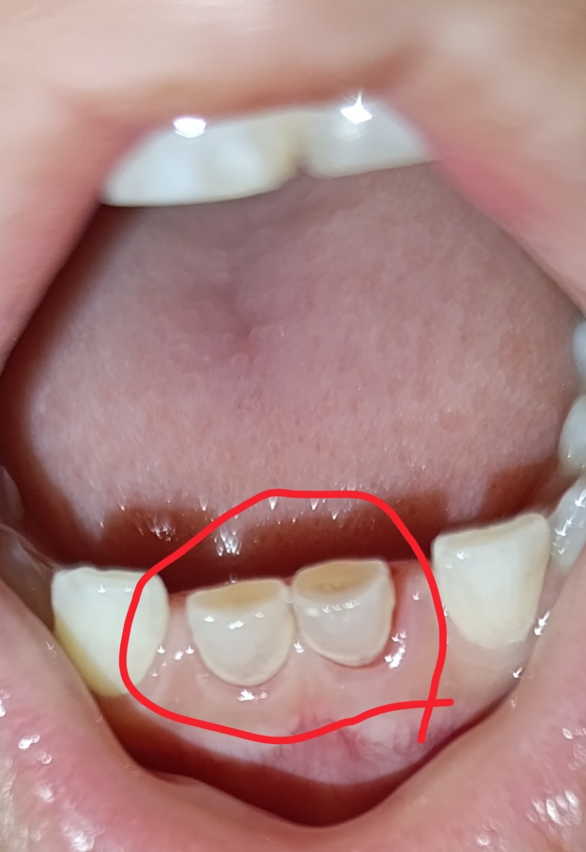 این دوتا داره میوفته این دوتا داره میوفته