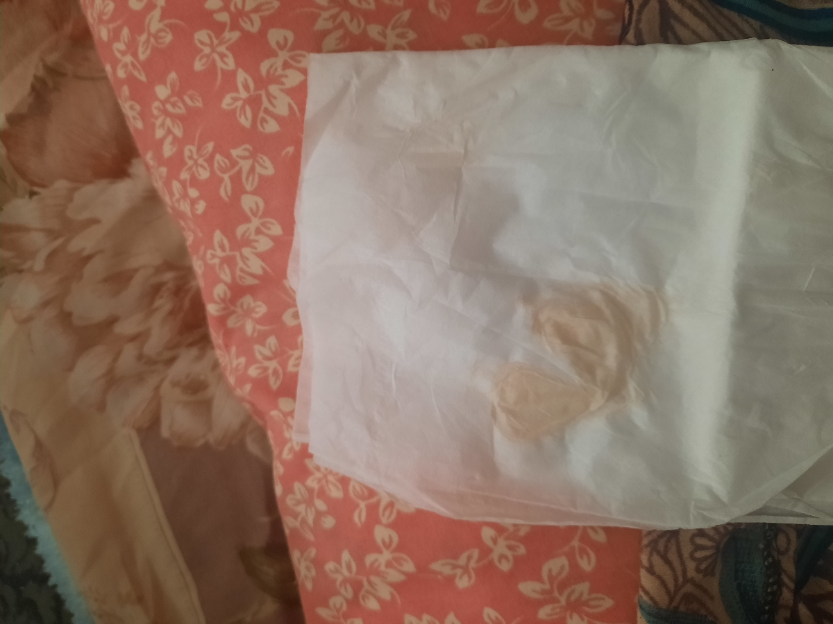 سلام خوبی ببخشید بابت این عکس فرستادم 
ببینید این لکه بینی یاترشح خودم پاک کردم بادستمال 