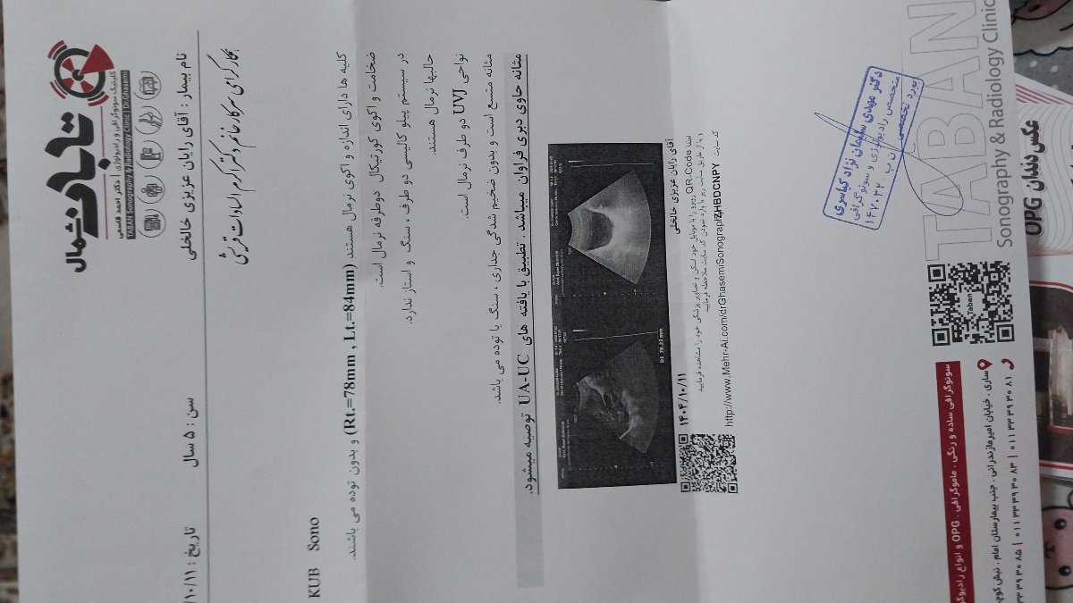 تفسیر ازمایش جدید و قدیم و اومدن خون از مجراری ادراری بعد از ادرار زرد رنگ تفسیر ازمایش جدید و قدیم و اومدن خون از مجراری ادراری بعد از ادرار زرد رنگ
