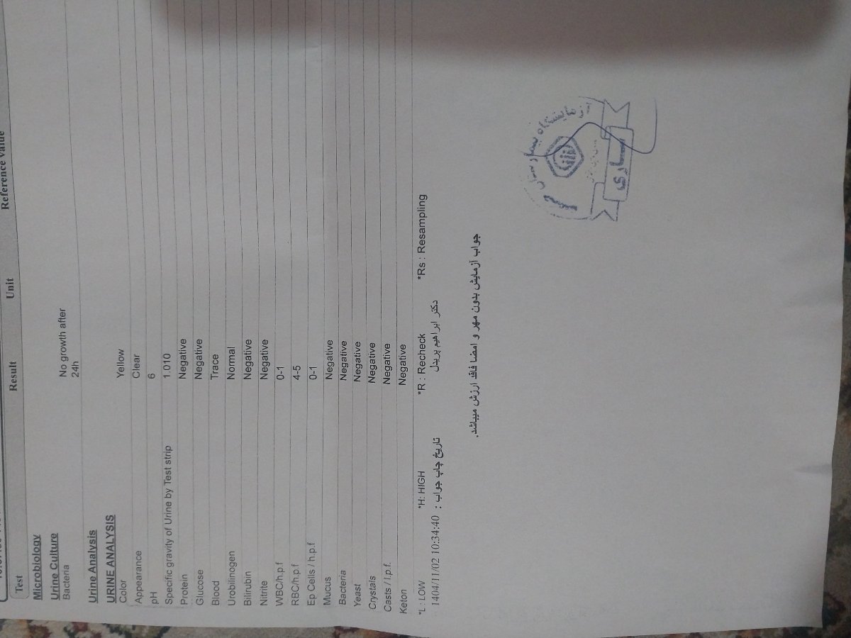 تفسیر ازمایش جدید و قدیم و اومدن خون از مجراری ادراری بعد از ادرار زرد رنگ تفسیر ازمایش جدید و قدیم و اومدن خون از مجراری ادراری بعد از ادرار زرد رنگ