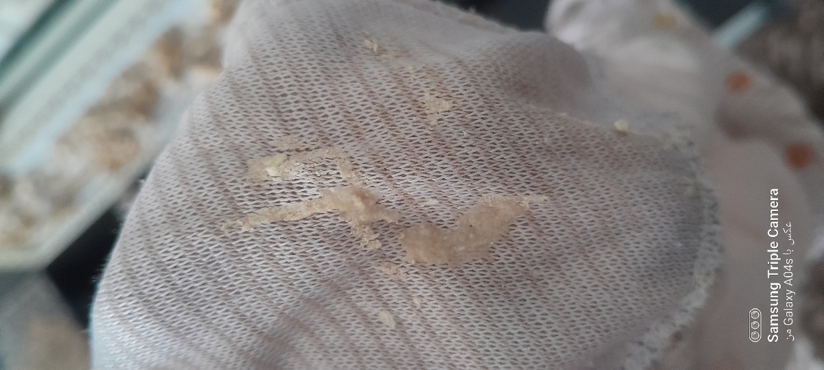 عذر میخام بابت عکس بازم ببخشید ترشحاتم اینطوریه شیاف نیستاتین هم دارم اما یه دکتر دیگه بهم داد دکتر خودم نداد عذر میخام بابت عکس بازم ببخشید ترشحاتم اینطوریه شیاف نیستاتین هم دارم اما یه دکتر دیگه بهم داد دکتر خودم نداد