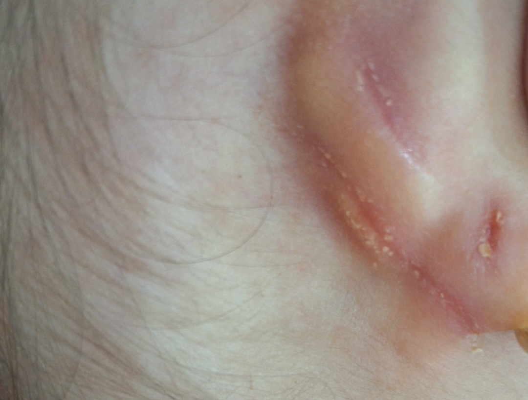 ترجمه متن ام آر آی گردن ترجمه متن ام آر آی گردن