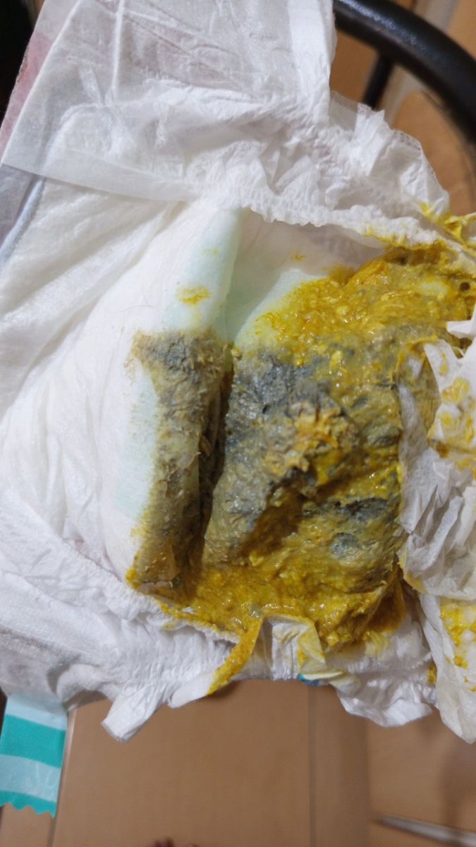 خانم دکتر نوزاد چهار ماهم دکتر بهش نئوزینک داده چند روزی میشدم رنگ مدفوعش عوض شد