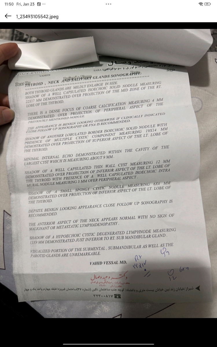 جواب آزمایش و نمونه برداری تیروئید جواب آزمایش و نمونه برداری تیروئید