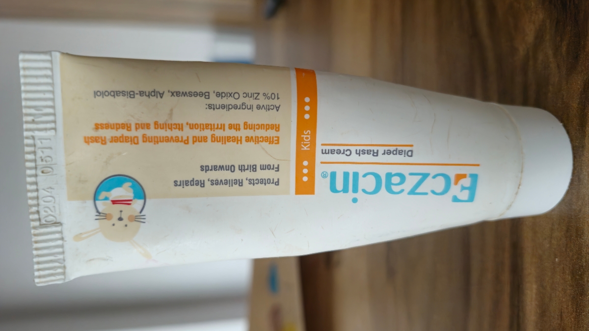 سوختگی نوزاد دختر سوختگی نوزاد دختر