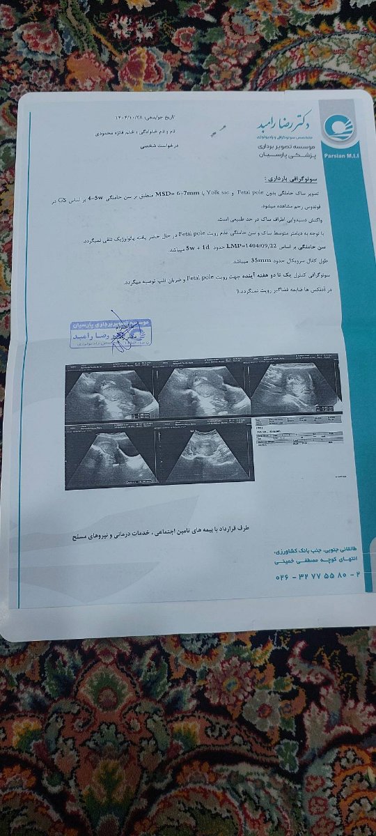 زمان سونو گرافی بعدی