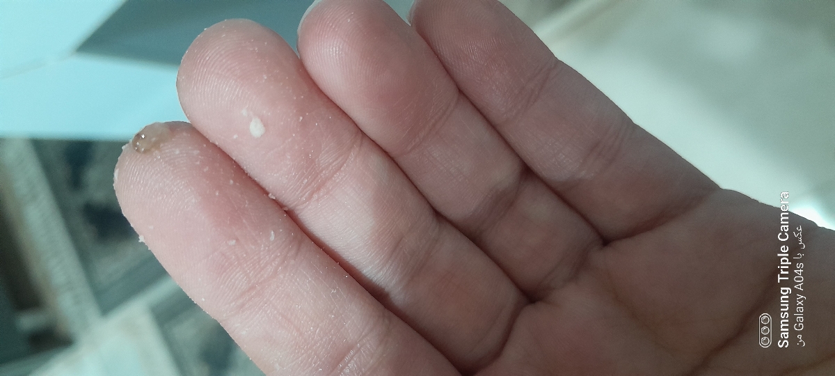 ترشحاتم ترشحاتم