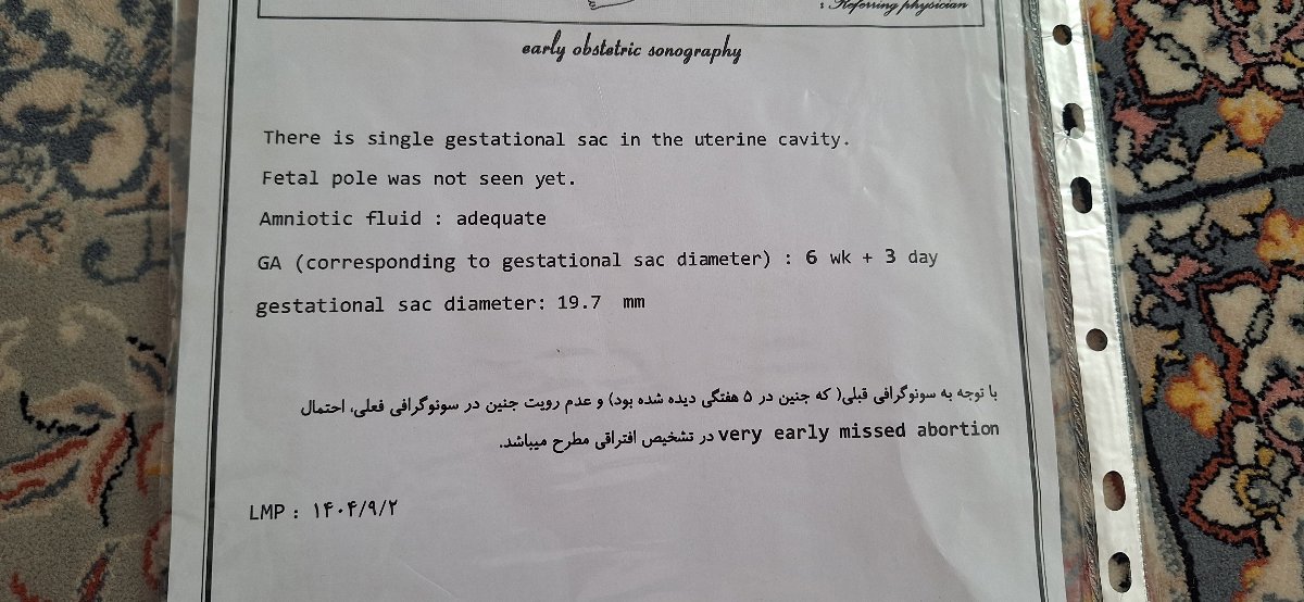 دومین سونو ۲۹ دی ماه 