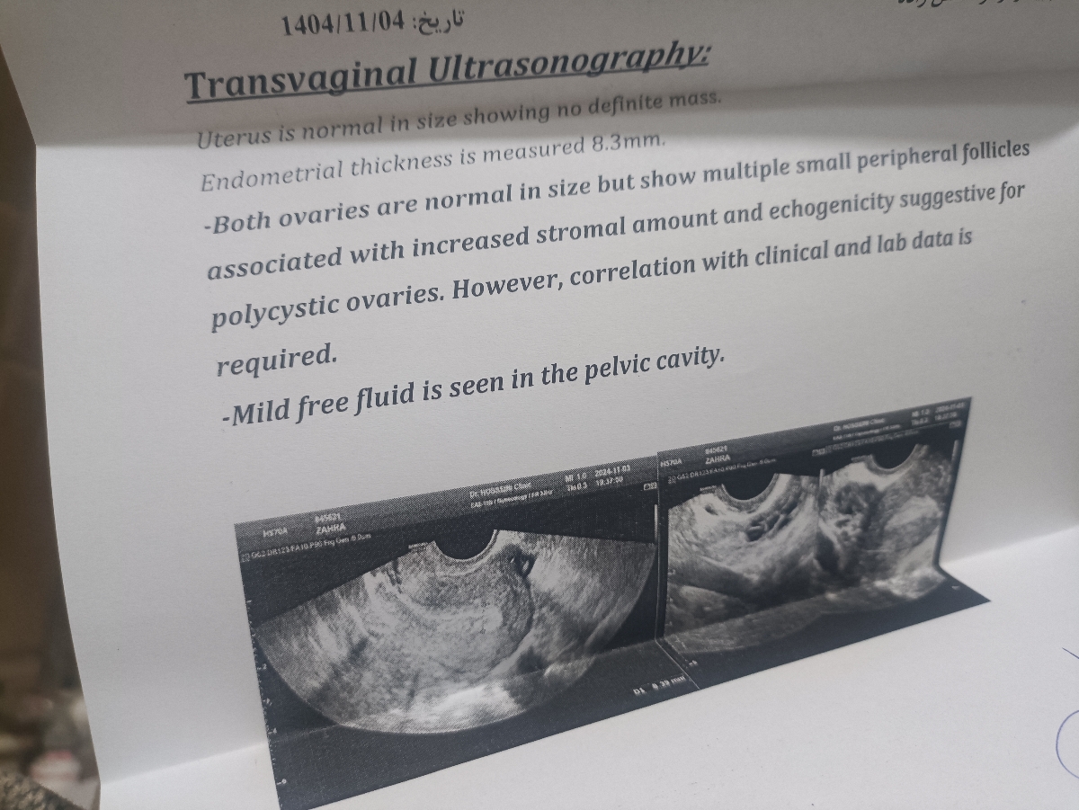 عقب افتادن پریود و سونو عقب افتادن پریود و سونو