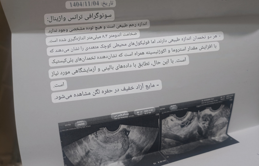 عقب افتادن پریود و سونو عقب افتادن پریود و سونو