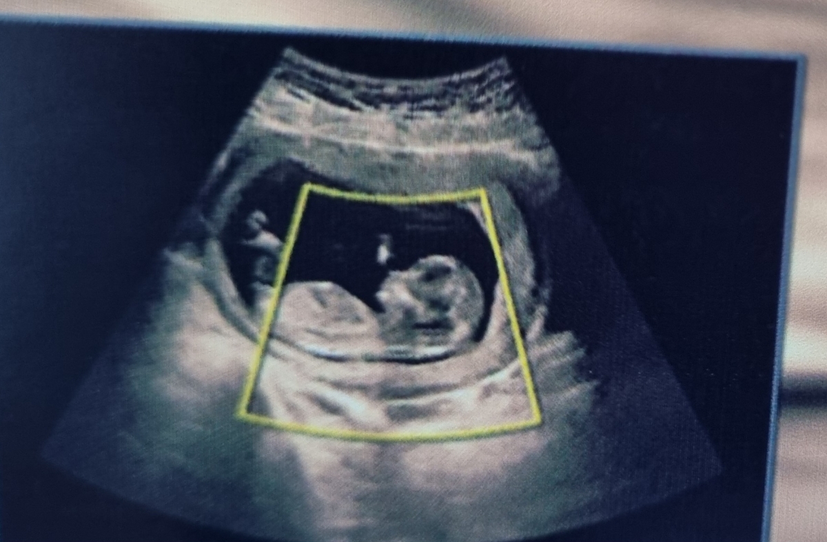 متخصصین تعیین جنسیت بیاین