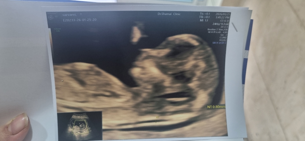 متخصصین تعیین جنسیت بیاین