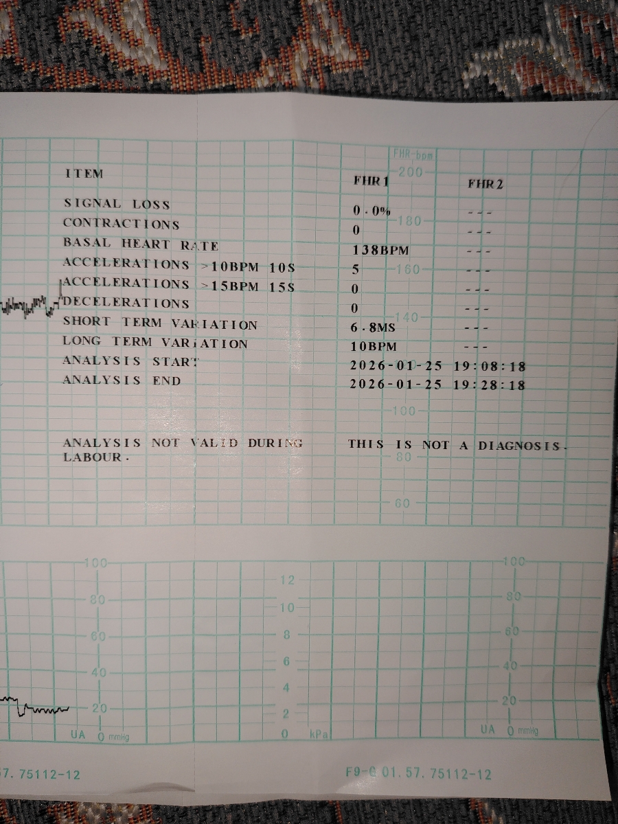 علائم زایمان تو هفته 35