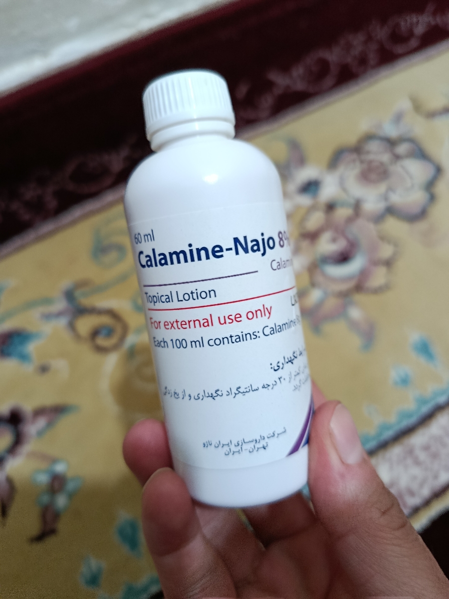 لوسيون موضعي كالامين كسي برا سوختگي پاي بچه استفاده كرده؟ لوسيون موضعي كالامين كسي برا سوختگي پاي بچه استفاده كرده؟