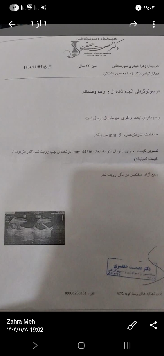 کیست تخمدان و جواب سونو