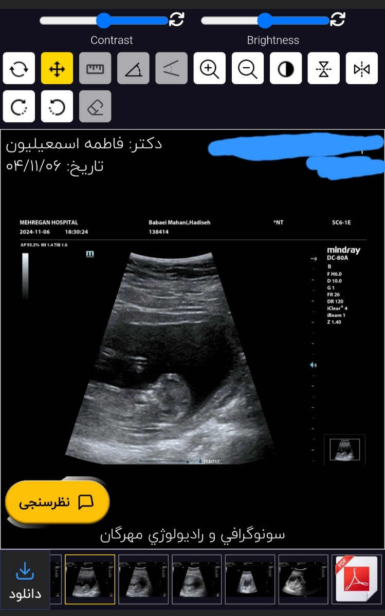 متخصصین تعیین جنسیت نظربدین