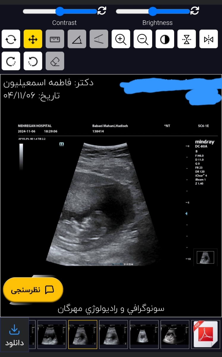 متخصصین تعیین جنسیت نظربدین