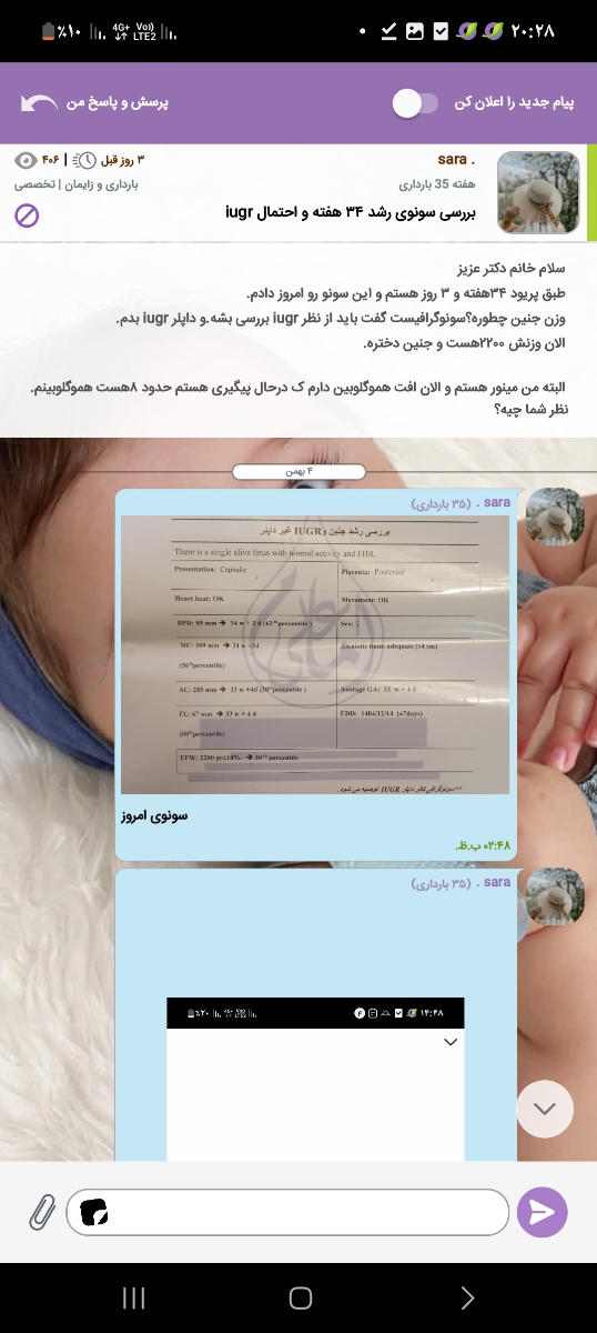 اینم ک سونو ۳۴هفته و ماجراهاش ک لطف کردین پاسخگو بودین اینم ک سونو ۳۴هفته و ماجراهاش ک لطف کردین پاسخگو بودین