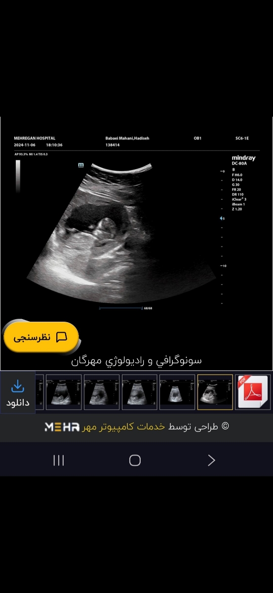 متخصصین تعیین جنسیت نظربدین