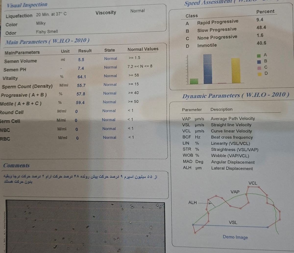 جواب ازمایش شوهرم واریکوسل
