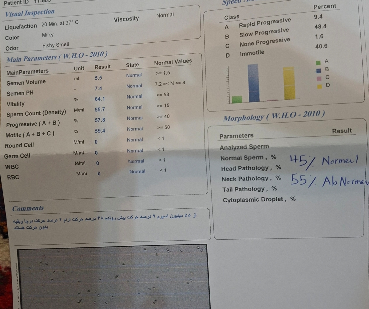 جواب ازمایش شوهرم واریکوسل