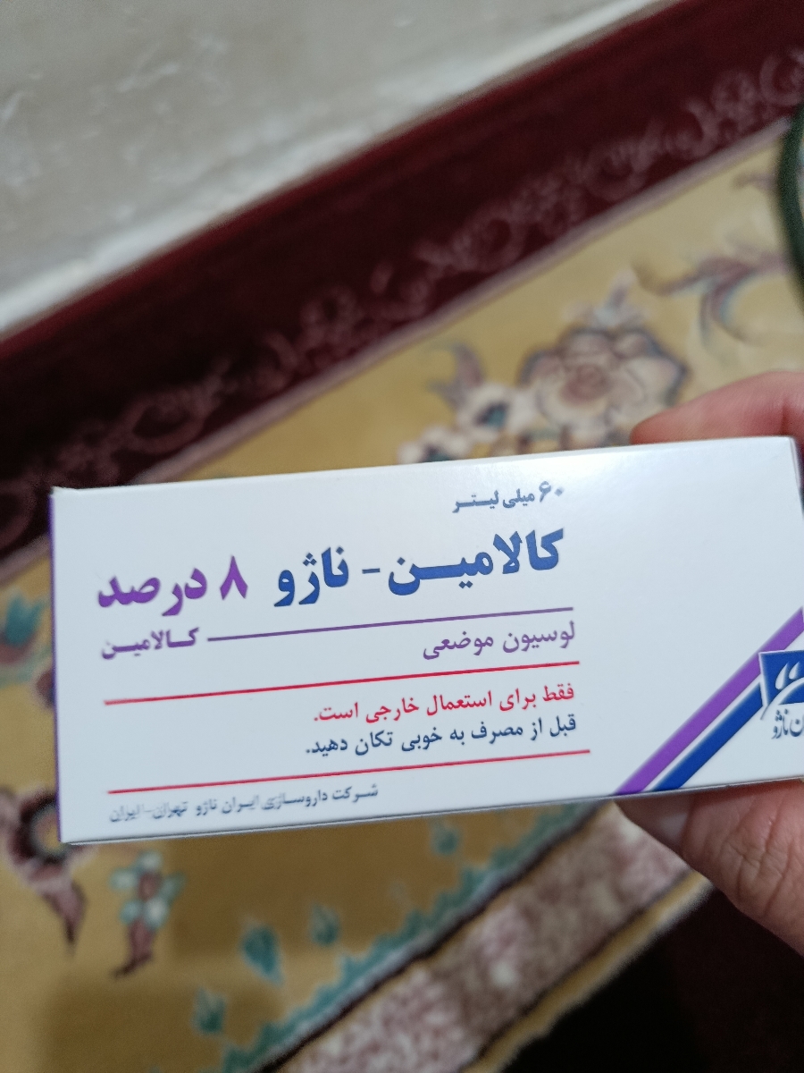 لوسيون كالامين براي سوختگي پاي نوزاد