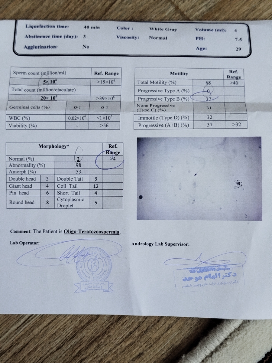 آزمایش اسپرم 