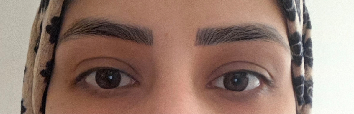 میکرو کردن ابروهای کم پشت